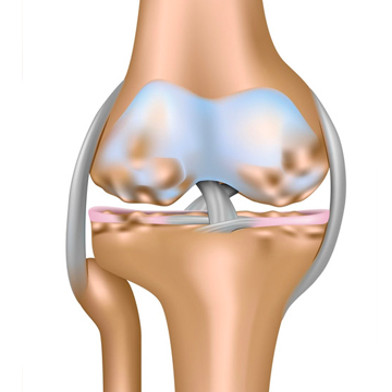 Artroza osteoartroza coxartroza